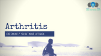 Arthritis: CBD Can Help You Get Your Life Back