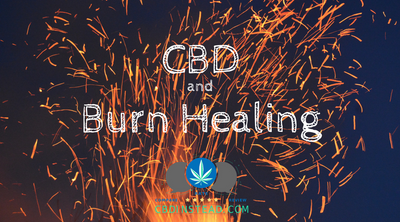 CBD and Burn Healing