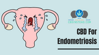 CBD For Endometriosis